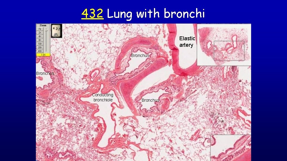 432 Lung with bronchi Elastic artery Bronchus Conducting bronchiole Bronchus 