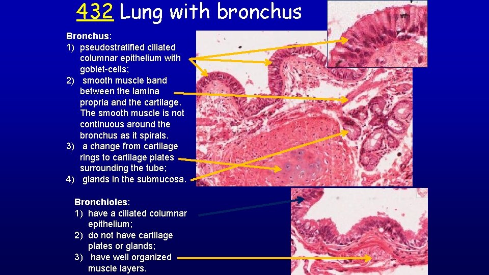 432 Lung with bronchus Bronchus: 1) pseudostratified ciliated columnar epithelium with goblet-cells; 2) smooth