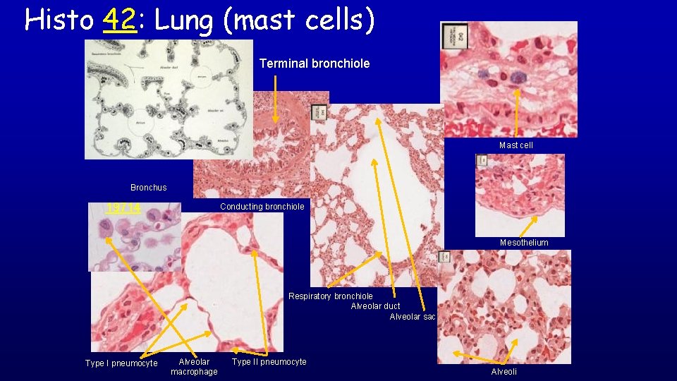 Histo 42: Lung (mast cells) Terminal bronchiole Mast cell Bronchus 19714 Conducting bronchiole Mesothelium