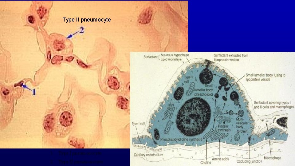 Type II pneumocyte 1. Type I pneumonocyte 2. Type II pneumonocyte 