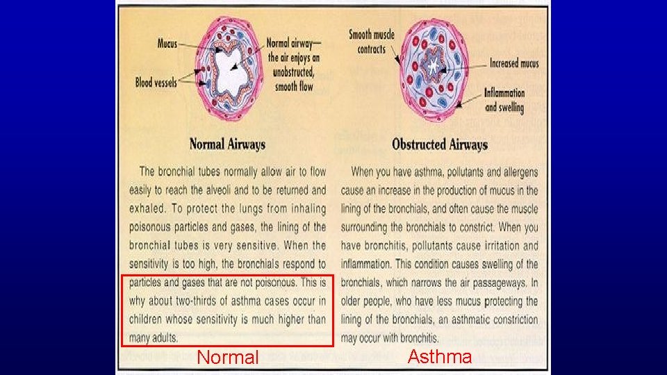 Normal Asthma 