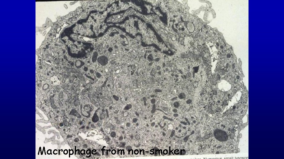 Macrophage from non-smoker 