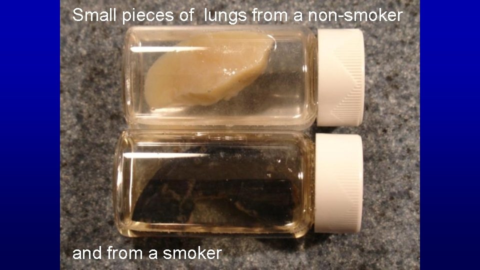Small pieces of lungs from a non-smoker and from a smoker 