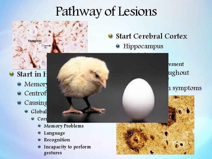 Pathway of Lesions Start Cerebral Cortex Hippocampus Whole brain Start in Hippocampus Memory &