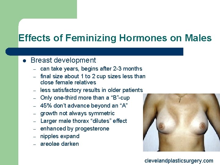 Effects of Feminizing Hormones on Males l Breast development – – – – – Effects of Feminizing Hormones on Males l Breast development – – – – –