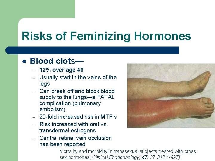 Risks of Feminizing Hormones l Blood clots— – – – 12% over age 40 Risks of Feminizing Hormones l Blood clots— – – – 12% over age 40
