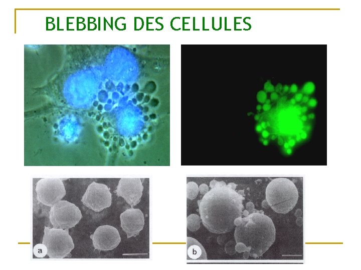 BLEBBING DES CELLULES 