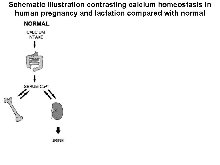 Schematic illustration contrasting calcium homeostasis in human pregnancy and lactation compared with normal Pregnancy-induced
