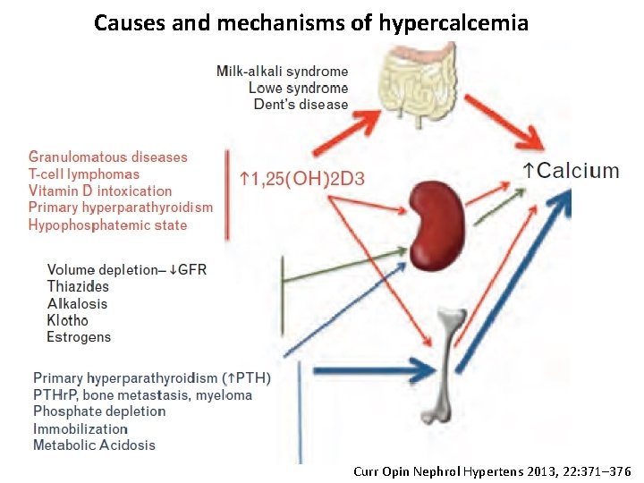 Causes and mechanisms of hypercalcemia Curr Opin Nephrol Hypertens 2013, 22: 371– 376 