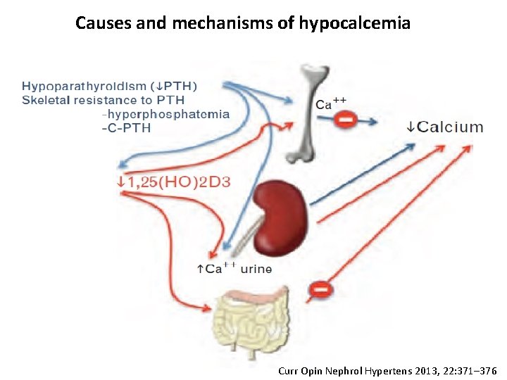 Causes and mechanisms of hypocalcemia Curr Opin Nephrol Hypertens 2013, 22: 371– 376 