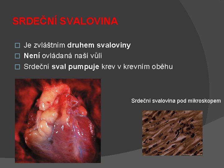 SRDEČNÍ SVALOVINA Je zvláštním druhem svaloviny � Není ovládaná naší vůlí Není � Srdeční