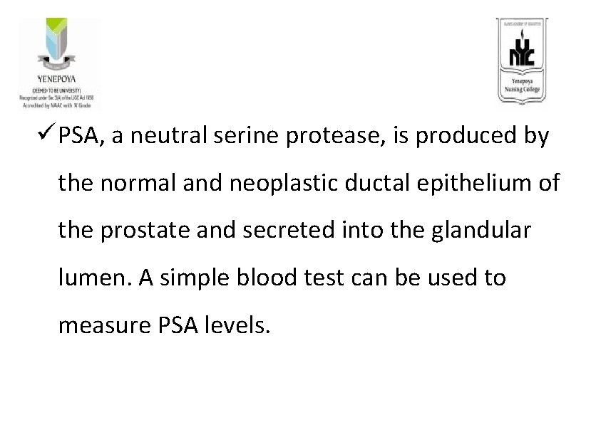 ü PSA, a neutral serine protease, is produced by the normal and neoplastic ductal