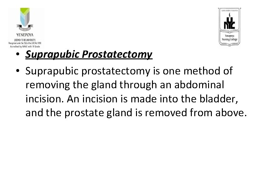  • Suprapubic Prostatectomy • Suprapubic prostatectomy is one method of removing the gland