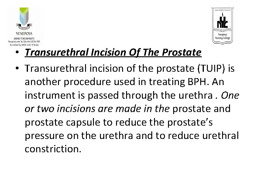  • Transurethral Incision Of The Prostate • Transurethral incision of the prostate (TUIP)