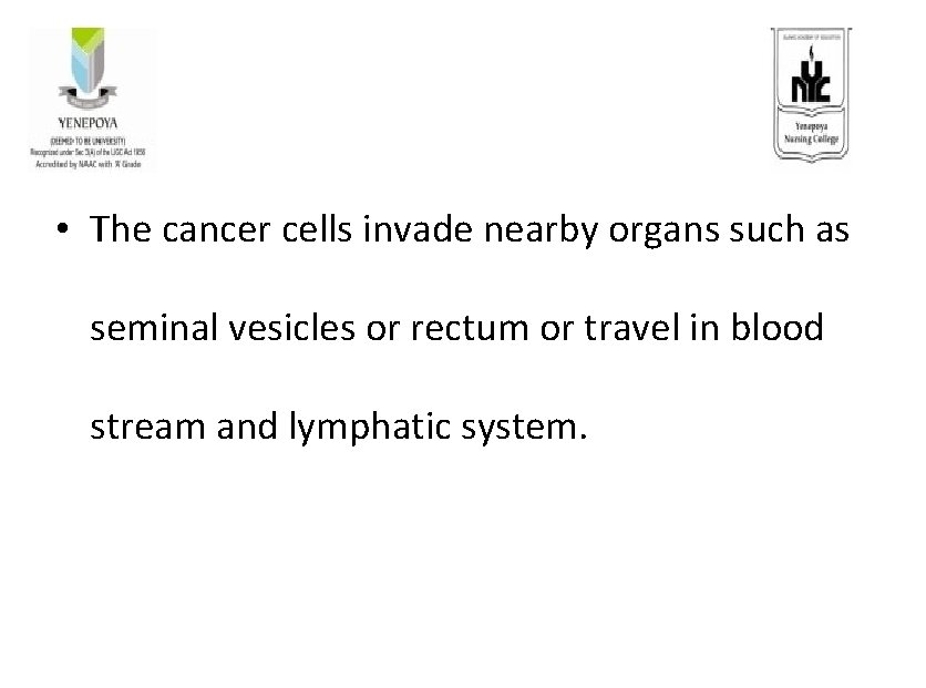  • The cancer cells invade nearby organs such as seminal vesicles or rectum