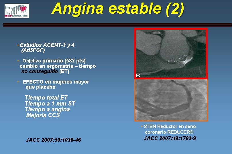 Angina estable (2) • Estudios AGENT-3 y 4 (Ad 5 FGF) • Objetivo primario