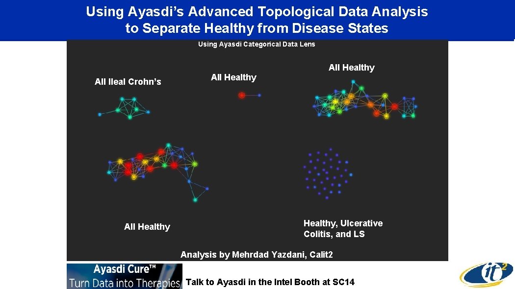 Using Ayasdi’s Advanced Topological Data Analysis to Separate Healthy from Disease States Using Ayasdi