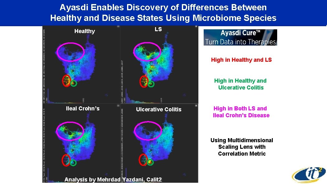 Ayasdi Enables Discovery of Differences Between Healthy and Disease States Using Microbiome Species Healthy