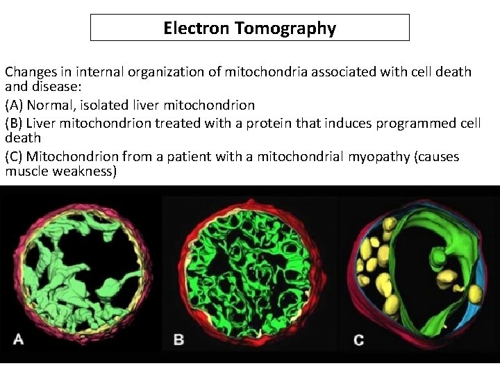 Electron Tomography Changes in internal organization of mitochondria associated with cell death and disease: