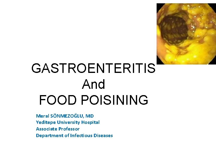 GASTROENTERITIS And FOOD POISINING Meral SÖNMEZOĞLU, MD Yeditepe University Hospital Associate Professor Department of