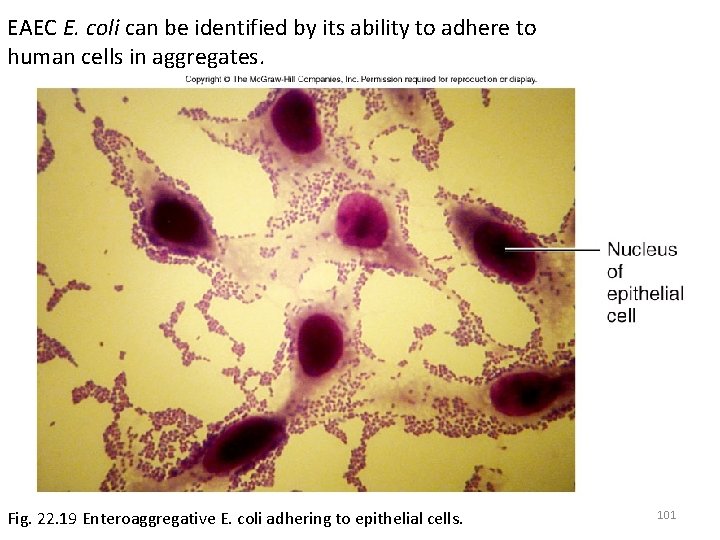 EAEC E. coli can be identified by its ability to adhere to human cells