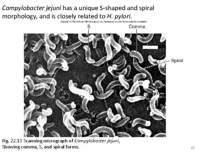 Campylobacter jejuni has a unique S-shaped and spiral morphology, and is closely related to