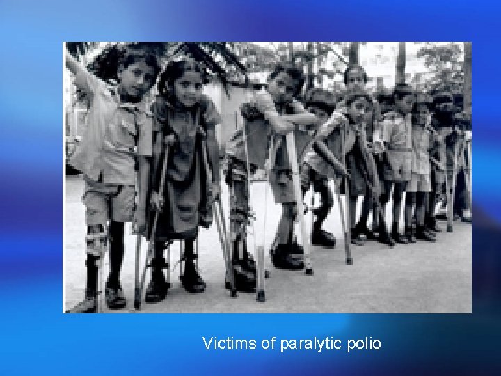 Victims of paralytic polio 