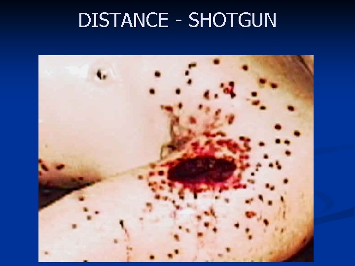 DISTANCE - SHOTGUN 