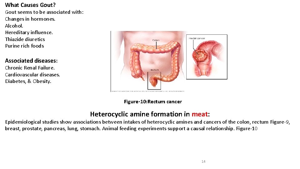 What Causes Gout? Gout seems to be associated with: Changes in hormones. Alcohol. Hereditary