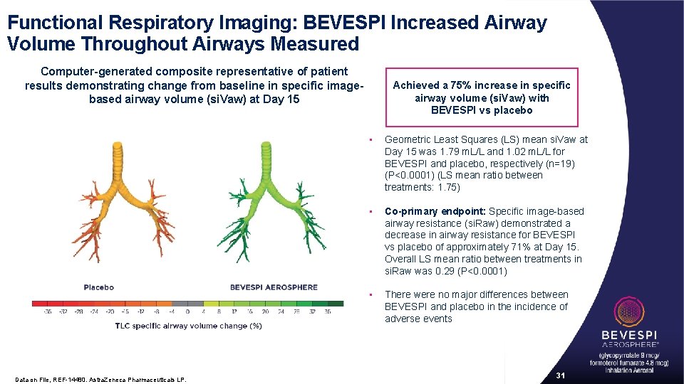 Functional Respiratory Imaging: BEVESPI Increased Airway Volume Throughout Airways Measured Computer-generated composite representative of