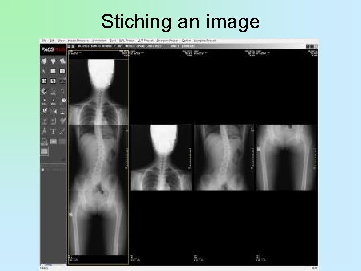 Stiching an image 