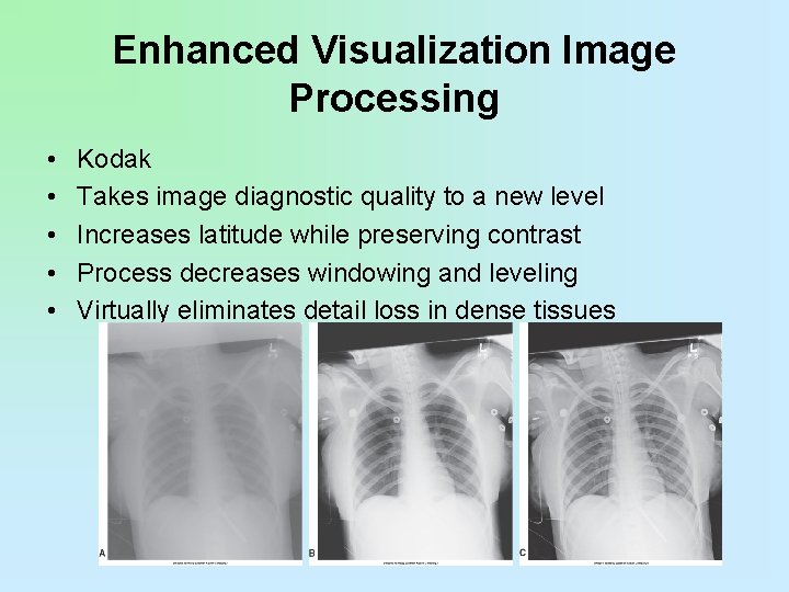 Enhanced Visualization Image Processing • • • Kodak Takes image diagnostic quality to a