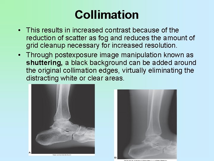 Collimation • This results in increased contrast because of the reduction of scatter as