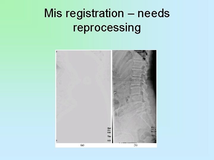 Mis registration – needs reprocessing 