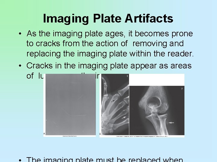 Imaging Plate Artifacts • As the imaging plate ages, it becomes prone to cracks