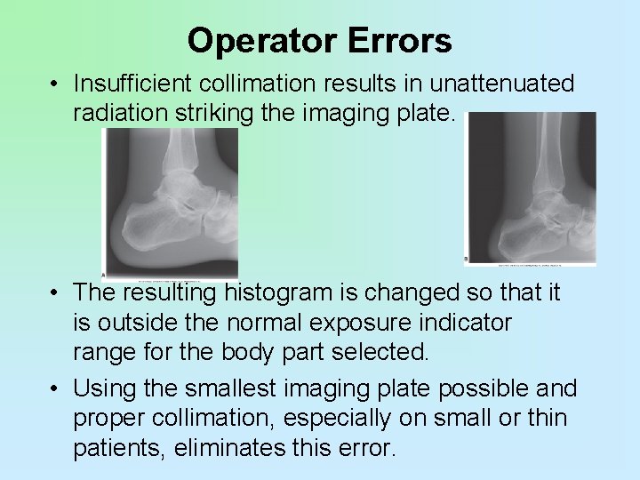 Operator Errors • Insufficient collimation results in unattenuated radiation striking the imaging plate. •