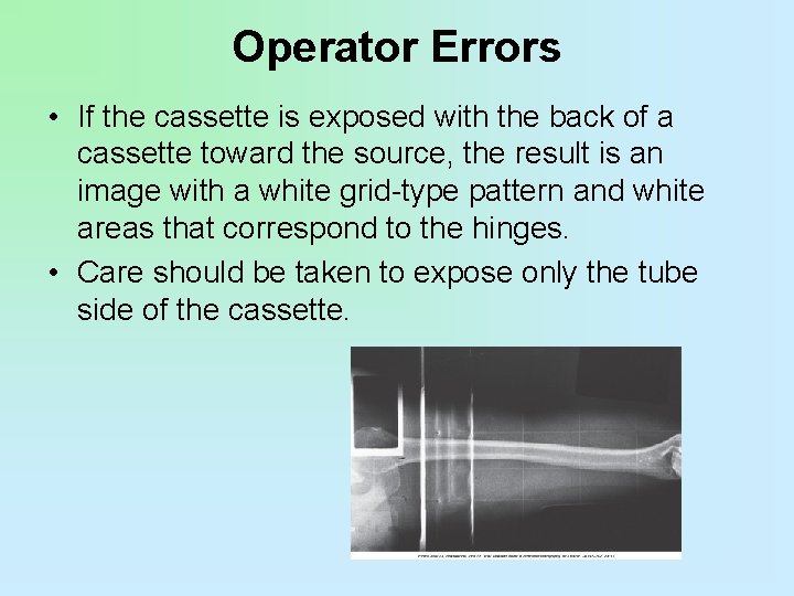 Operator Errors • If the cassette is exposed with the back of a cassette