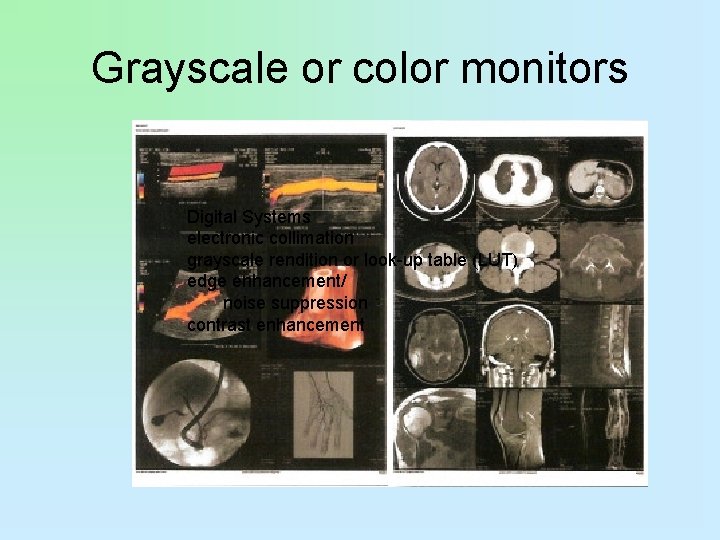 Grayscale or color monitors Digital Systems electronic collimation grayscale rendition or look-up table (LUT)