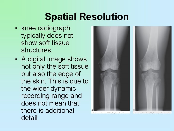 Spatial Resolution • knee radiograph typically does not show soft tissue structures. • A