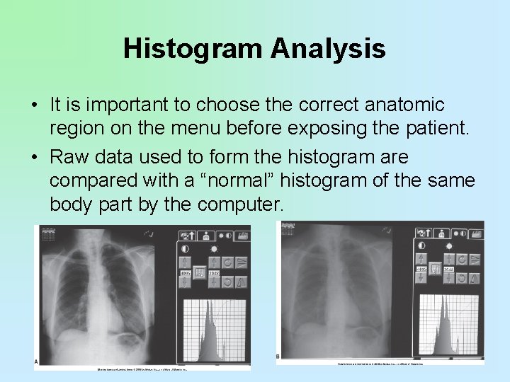 Histogram Analysis • It is important to choose the correct anatomic region on the