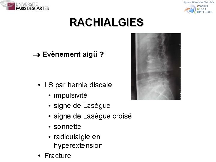 RACHIALGIES Evènement aigü ? LS par hernie discale • impulsivité • signe de Lasègue