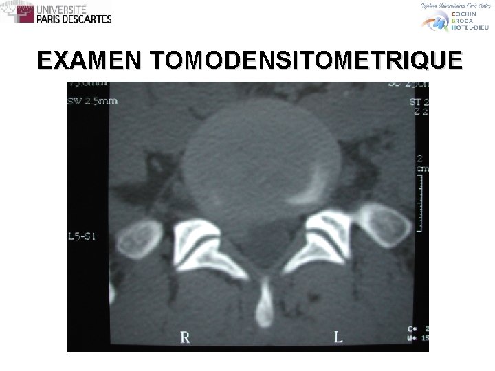 EXAMEN TOMODENSITOMETRIQUE 