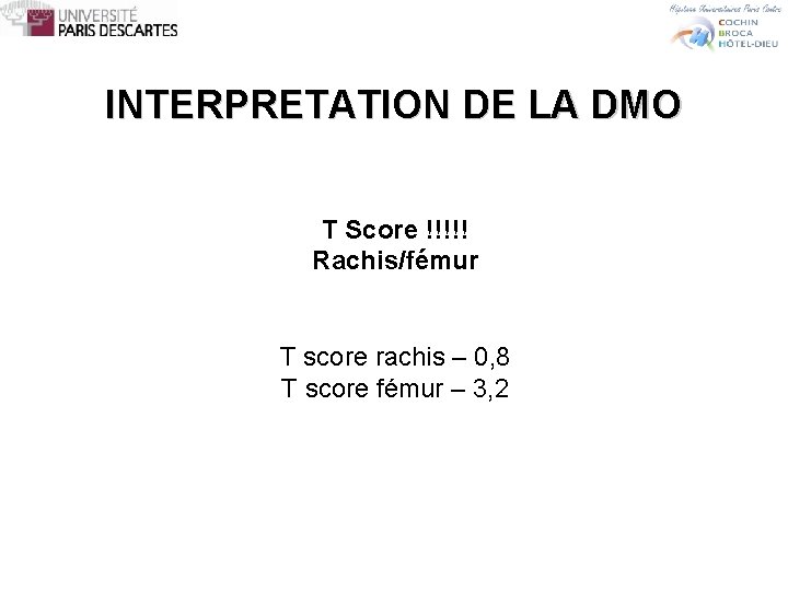 INTERPRETATION DE LA DMO T Score !!!!! Rachis/fémur T score rachis – 0, 8