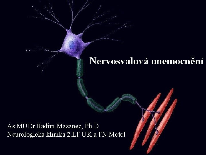 Nervosvalová onemocnění As. MUDr. Radim Mazanec, Ph. D Neurologická klinika 2. LF UK a