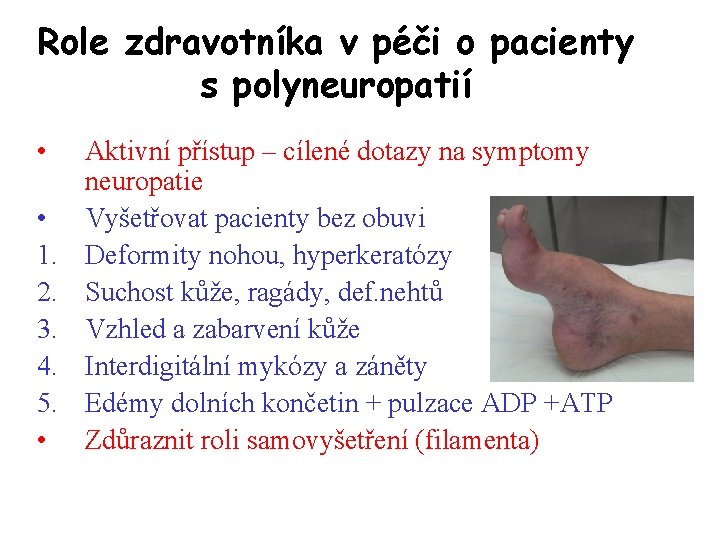 Role zdravotníka v péči o pacienty s polyneuropatií • • 1. 2. 3. 4.