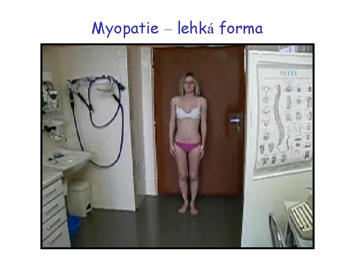 Myopatie – lehká forma 