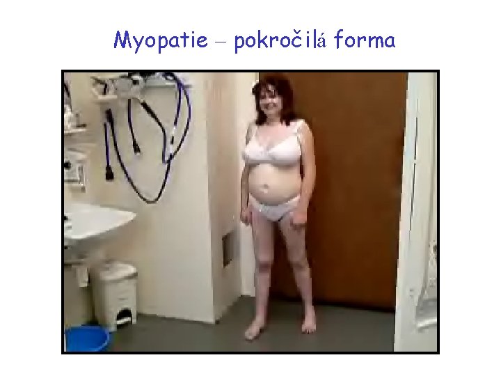 Myopatie – pokročilá forma 