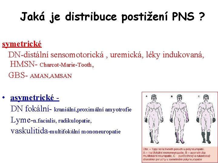 Jaká je distribuce postižení PNS ? symetrické DN-distální sensomotorická , uremická, léky indukovaná, HMSN-