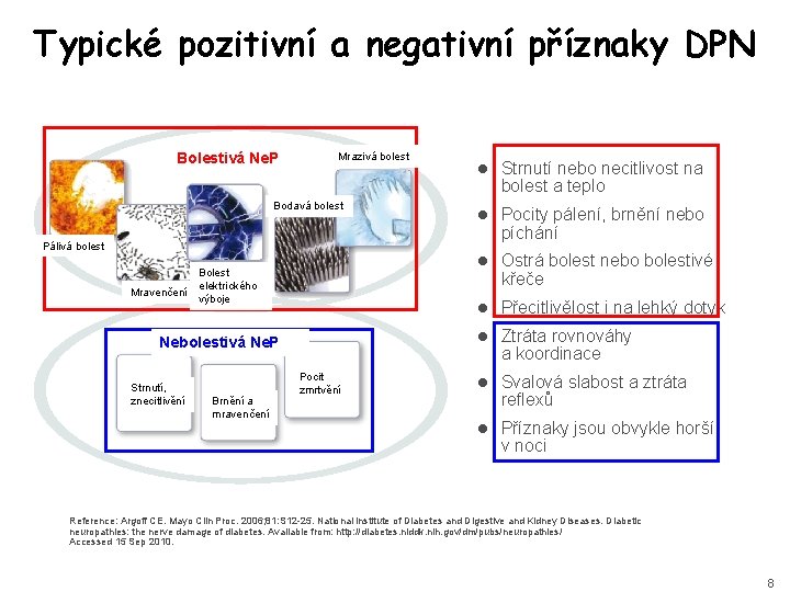 Typické pozitivní a negativní příznaky DPN Bolestivá Ne. P Mrazivá bolest Bodavá bolest l