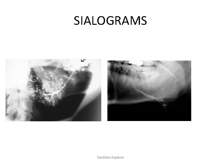 SIALOGRAMS Dentistry Explorer 